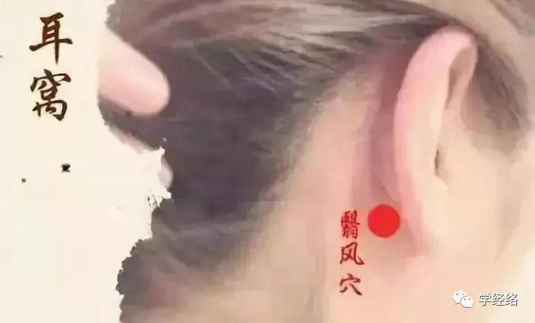 治疗耳鸣的穴位攻略