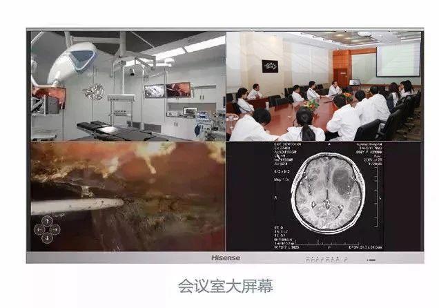 手术室里的第三只眼，做手术时的视频记录与意义