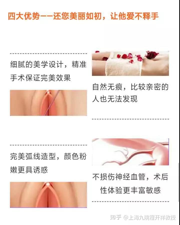 小阴唇肥大整形手术，从困惑到自信的美丽蜕变