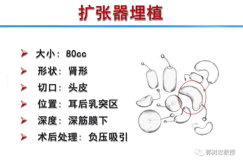 扩张器手术图片，深度解析与心理关怀