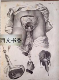 手术图片大全大图，透视医学的精细艺术