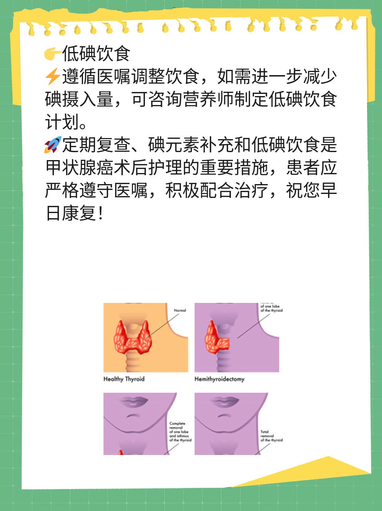 甲状腺手术后营养品选择与恢复加速指南