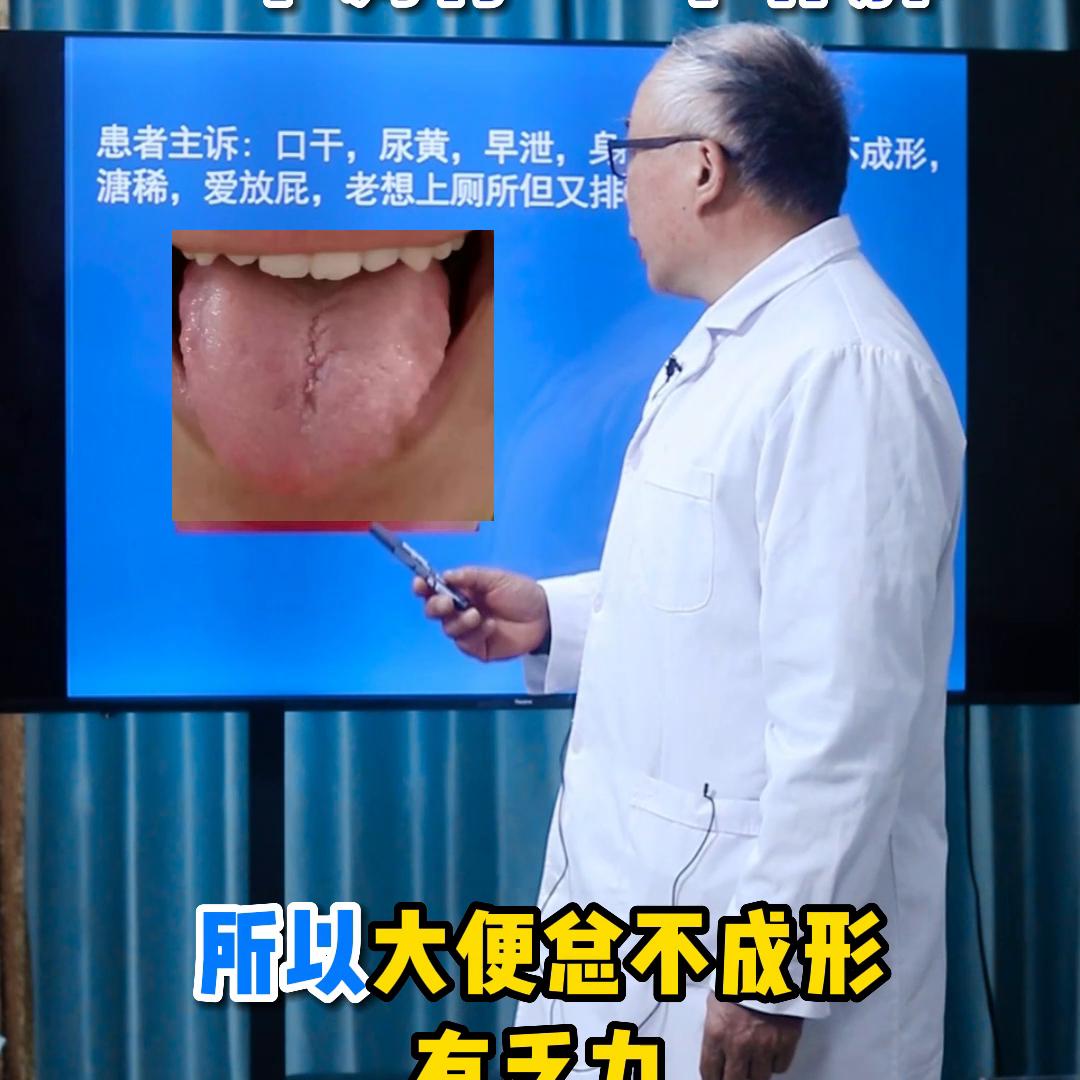 探索治疗早泄的中成药，自然之选，温和之效