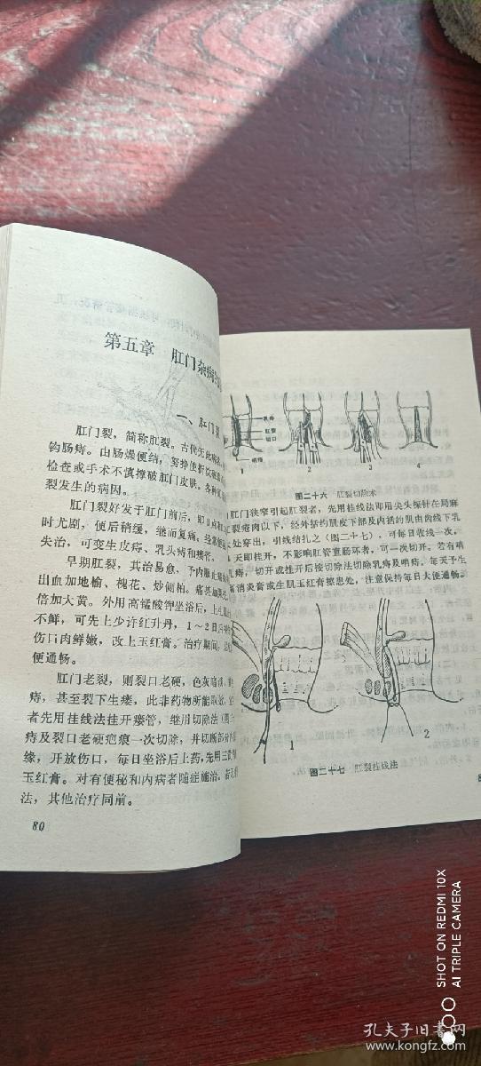探索中医治疗阳瘘的最佳方法