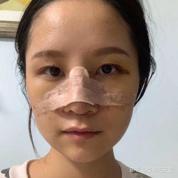 华山医院VS九院，上海点痣的双雄之争