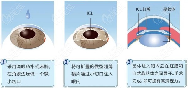慧眼识医，如何选择最适合的眼科医院